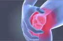Reasons of knee pain