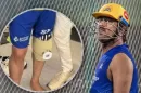 MS Dhoni Knee Surgery,