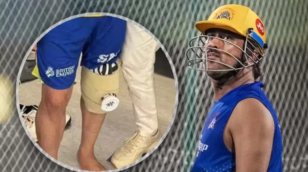 MS Dhoni Knee Surgery,