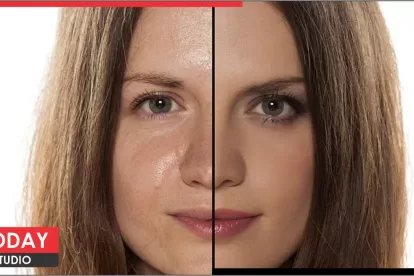 Oily Skin Care Tips