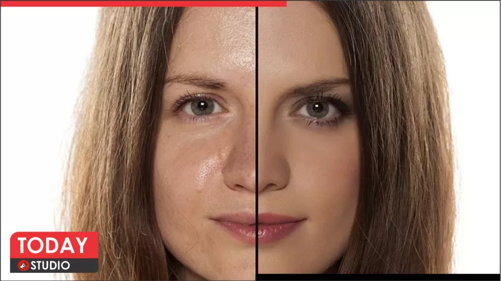 Oily Skin Care Tips