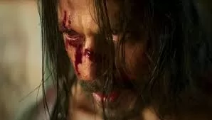 Shahrukh Khan Injured