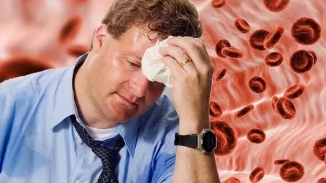 Excessive Sweating Effects