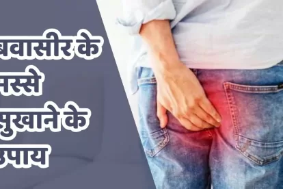 Piles Treatment Without Surgery