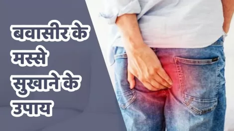 Piles Treatment Without Surgery