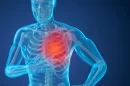 Pulmonary hypertension