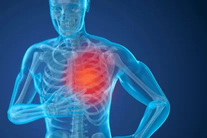 Pulmonary hypertension